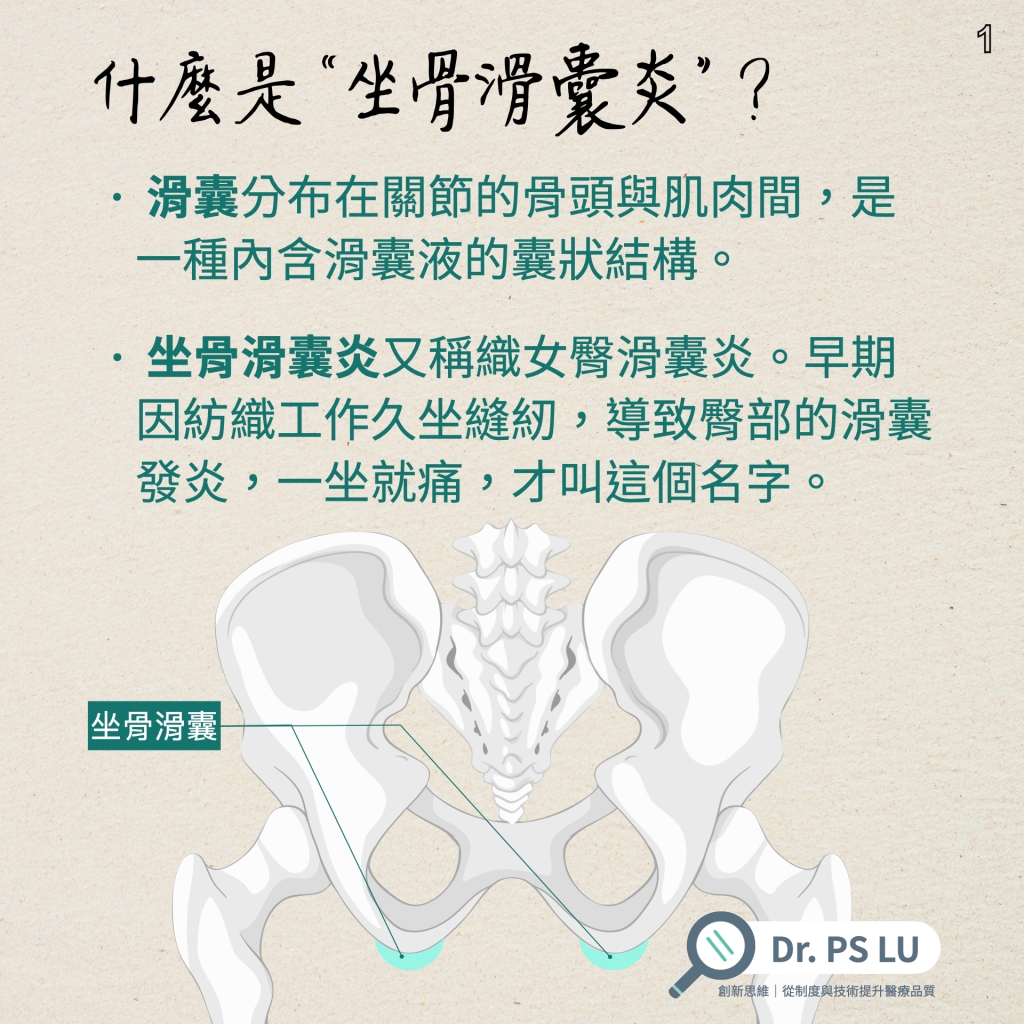 滑囊分布在關節的骨頭與肌肉間，是一種內含滑囊液的囊狀結構。
坐骨滑囊炎又稱織女臀滑囊炎。早期因紡織工作久坐縫紉，導致臀部的滑囊發炎，一坐就痛，才叫這個名字。